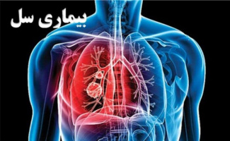 تکمیل طرح غربالگری( بیماری سل) اتباع خارجی در دانشکده علوم پزشکی تربت جام