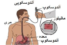 انجام ۴۳۶ مورد آندوسکوپی و کلونسکوپی در  مرکز آموزشی درمانی سجادیه تربت جام