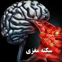 صدای سکته مغزی را بشنویم